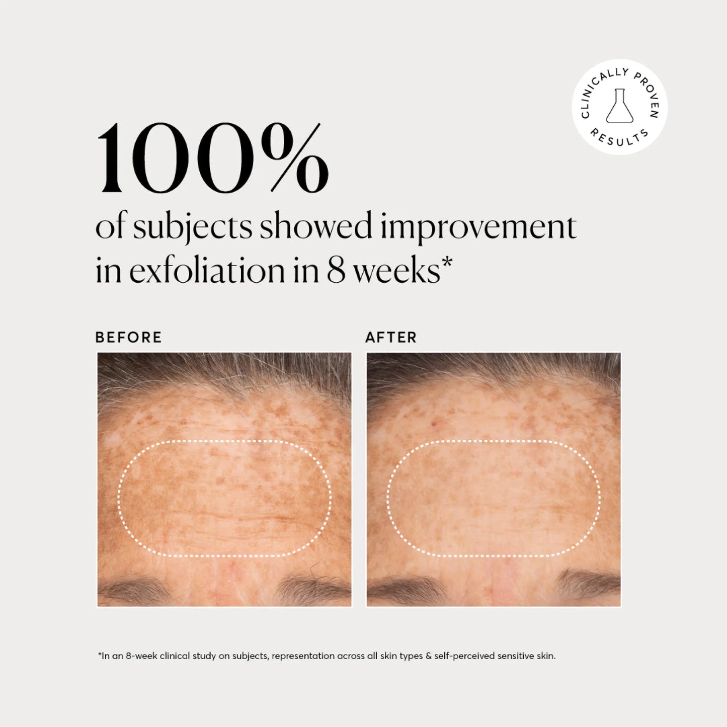 bha-liquid-exfoliant-2-t9 NATR-10027-Alt-Images-BHA-Liquid-Exfoliant-2_-03.webp