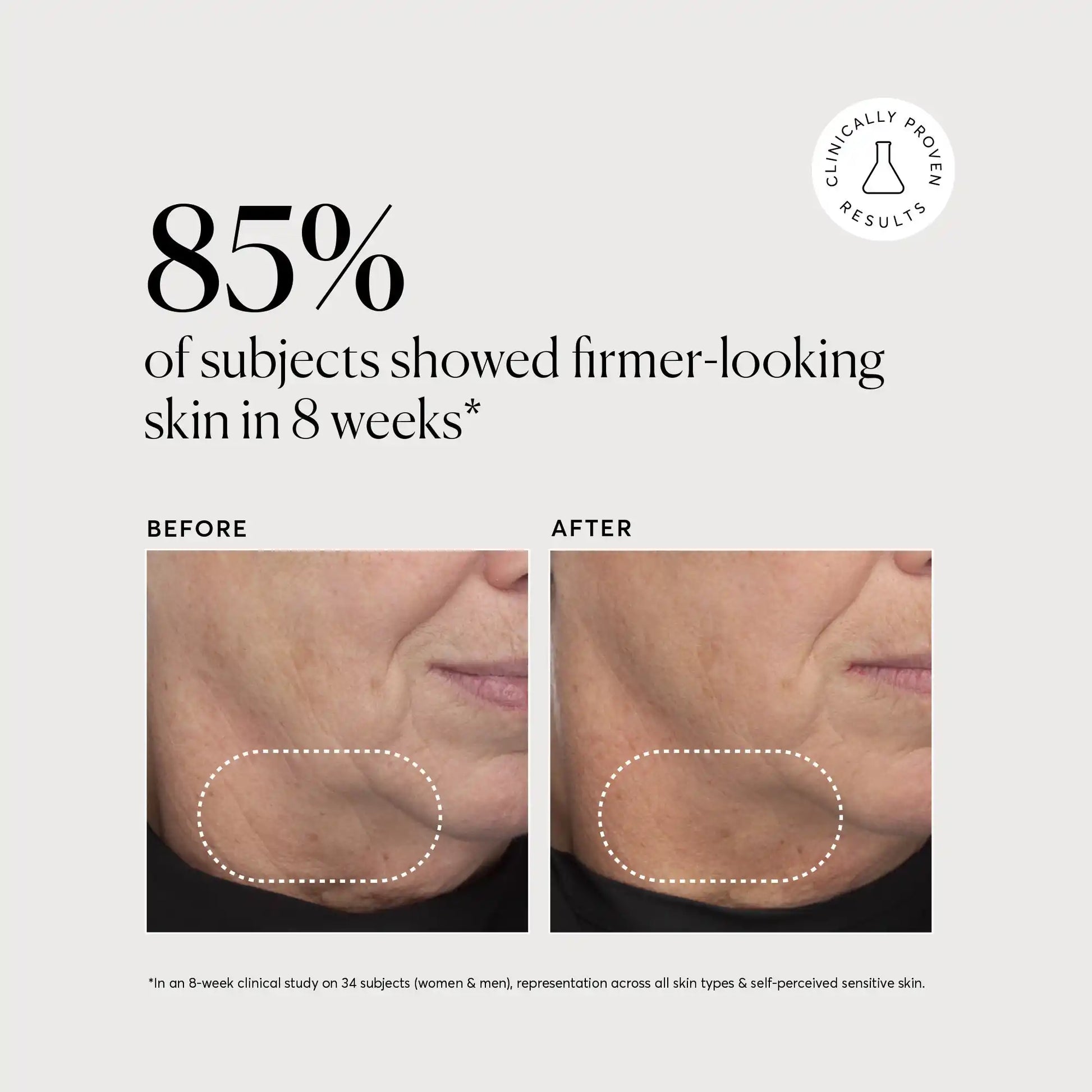 retinol-complex-serum-p2 NATR-10034-Alt-Images-Retinol-Complex-Serum-04.webp